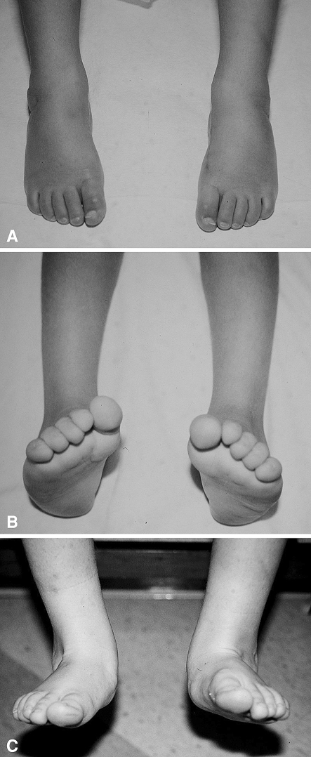 Fig. 2A–C