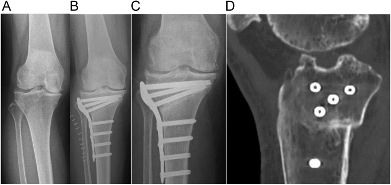 Fig. 2