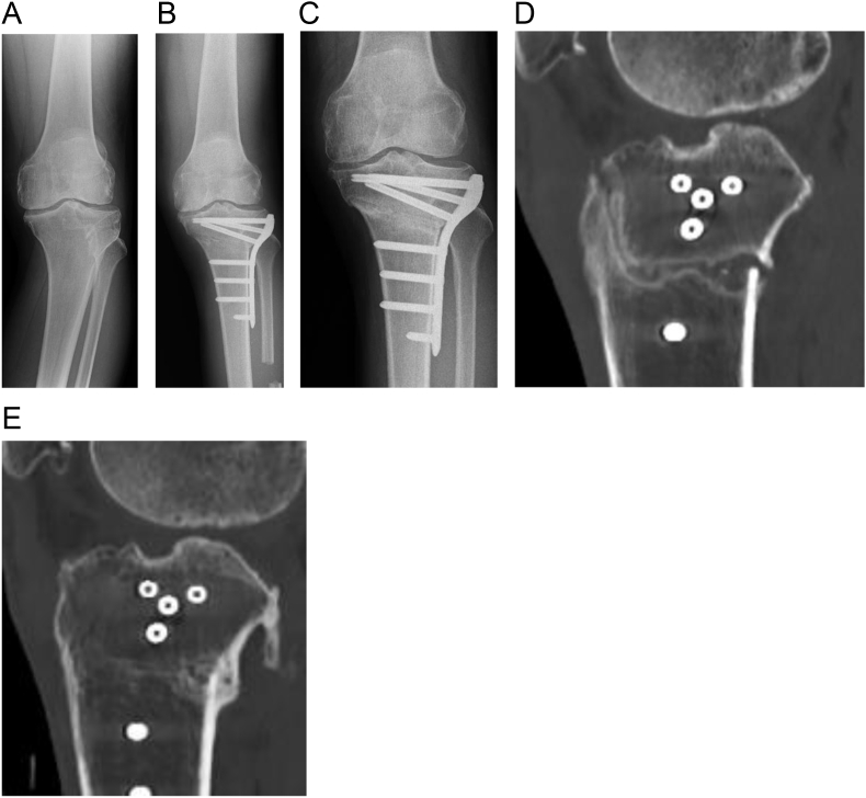 Fig. 1