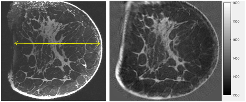 Fig. 11.