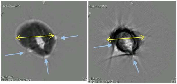 Fig. 16.