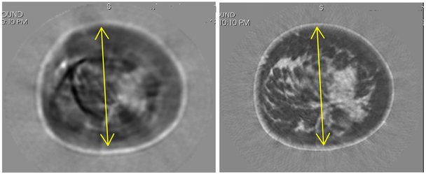 Fig. 15.