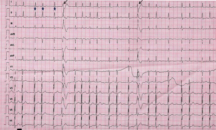 Figure 1