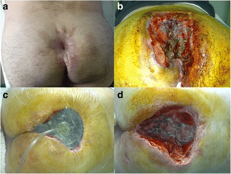 Fig. 1