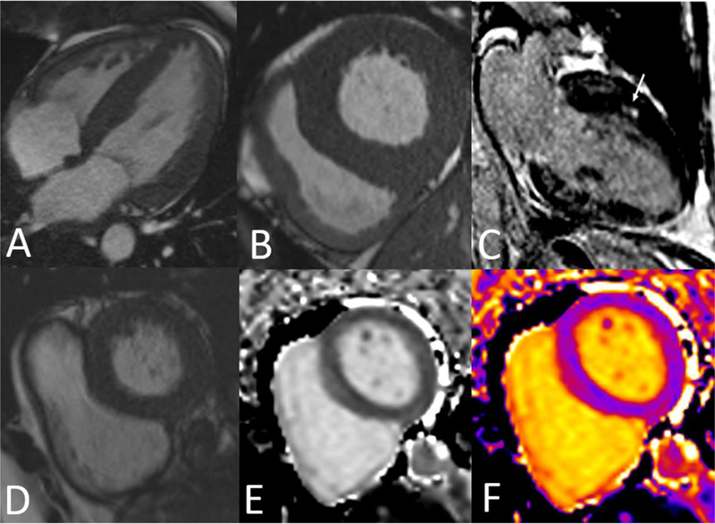 Figure 1: