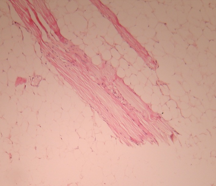 Fig. 6