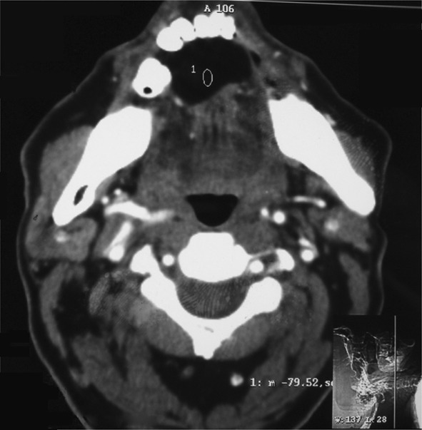 Fig. 3