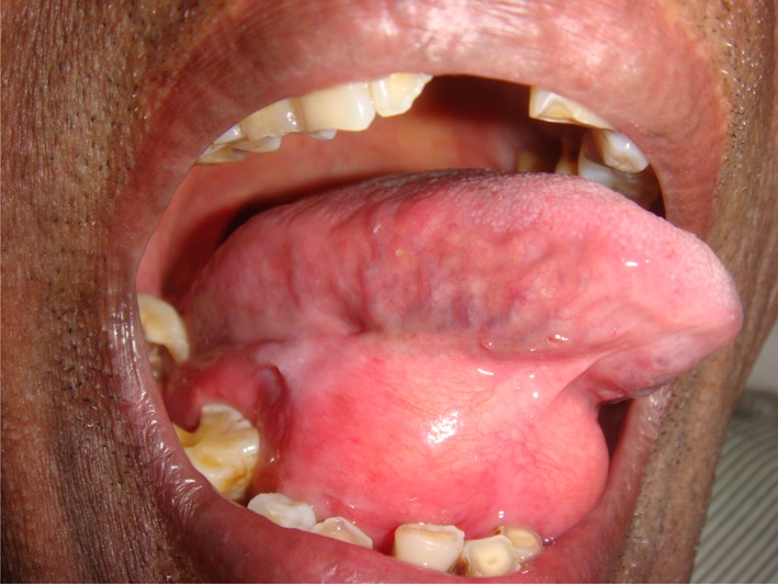 Fig. 1