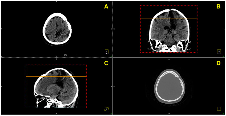 Figure 6