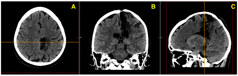 Figure 7