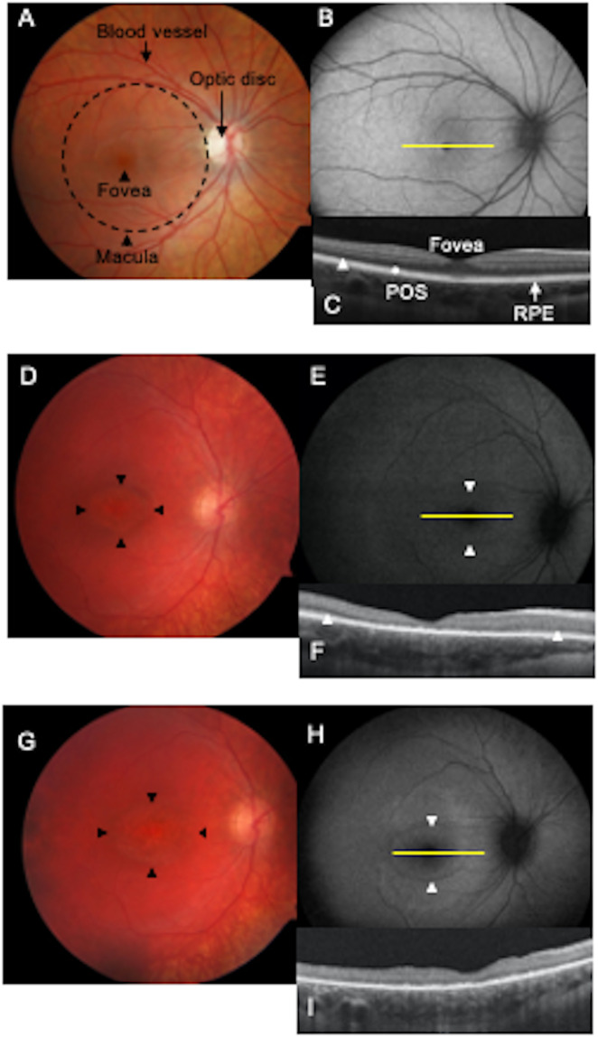 Fig. 9