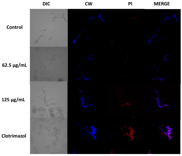 Figure 11