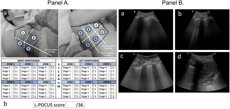 Fig 1