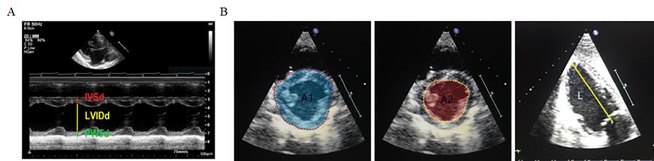 Echocardiographic Left Ventricular Mass Estimation: Two-Dimensional ...