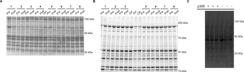 Figure 5—figure supplement 2.