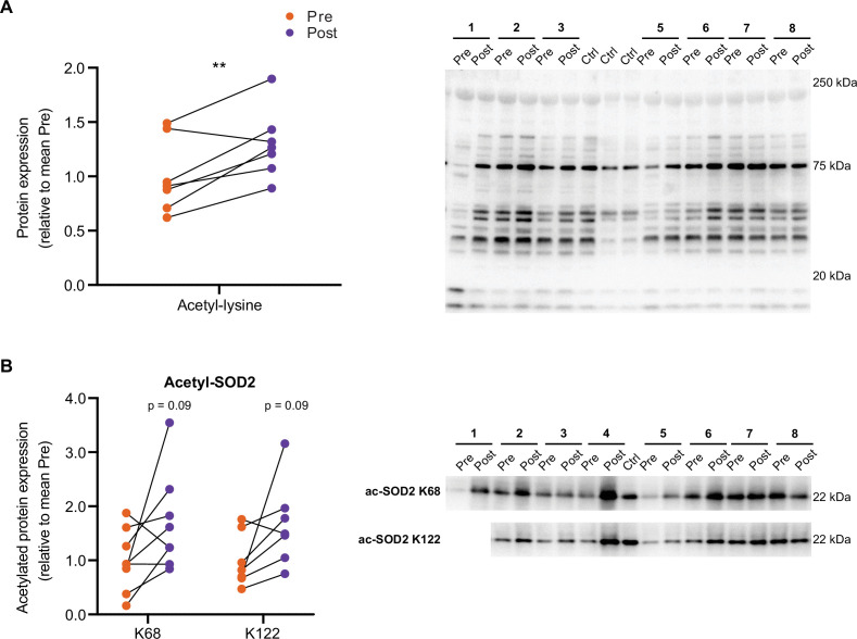 Figure 5—figure supplement 1.