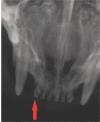 Figure 18