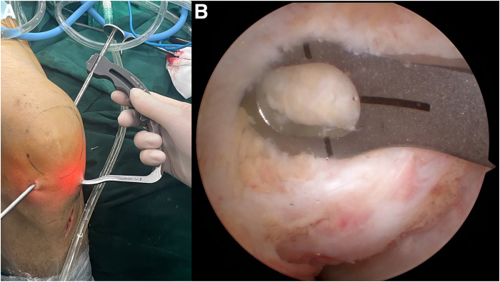 Fig 6