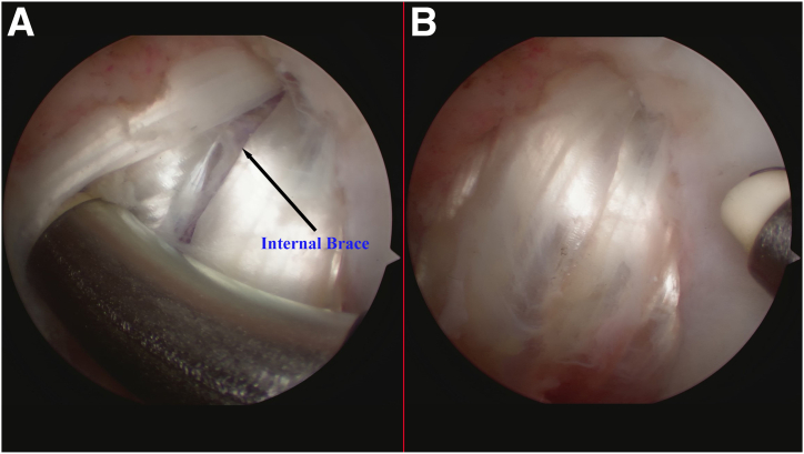 Fig 12