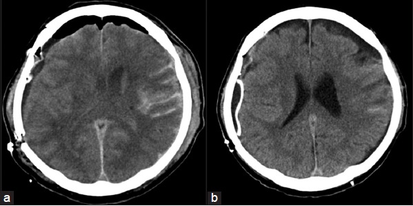 Figure 4: