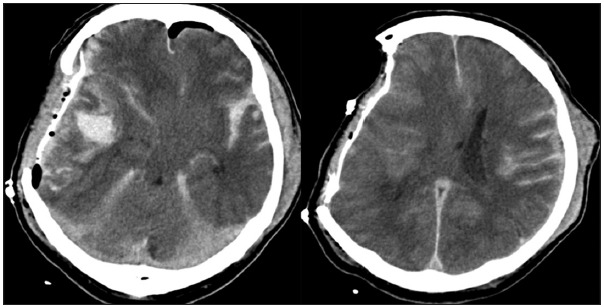 Figure 2: