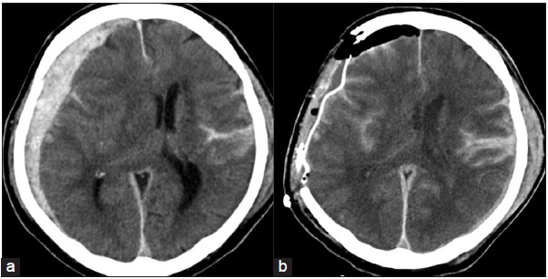 Figure 1: