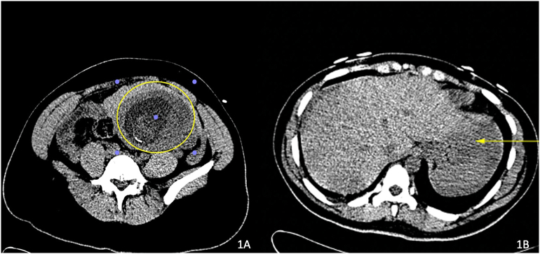 Fig. 1