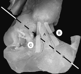 Fig. 4