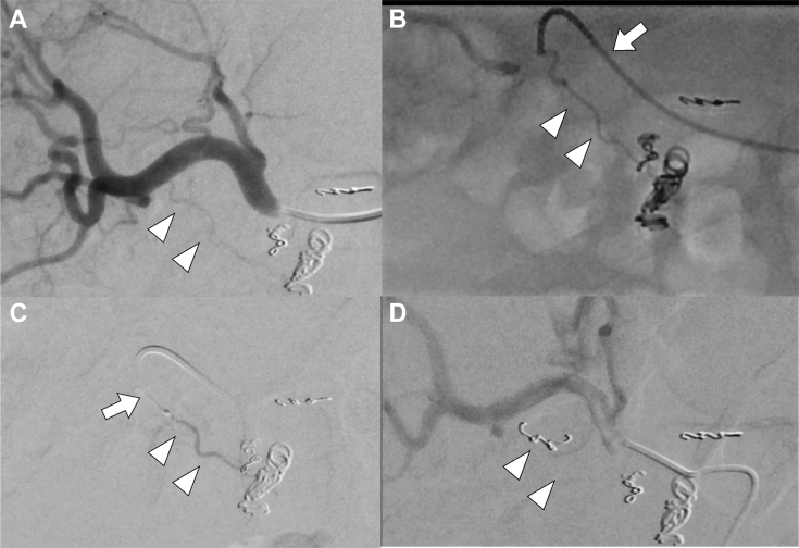 Fig. 1