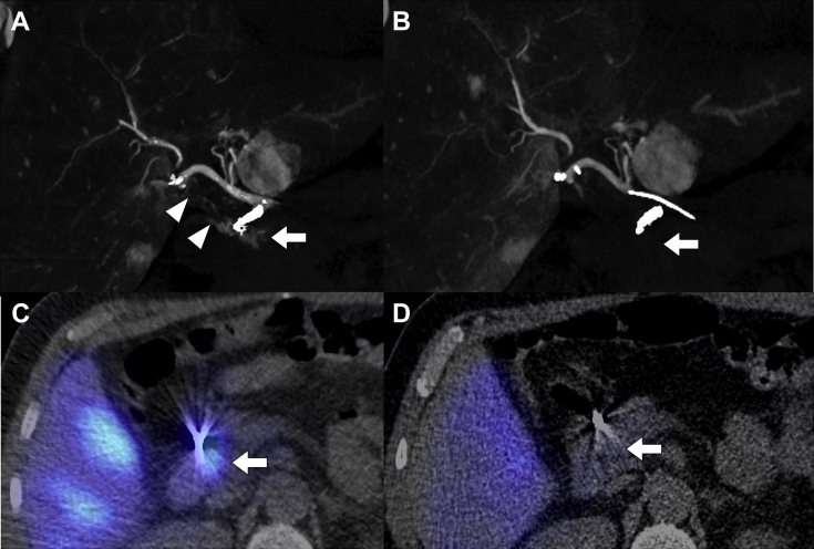 Fig. 3