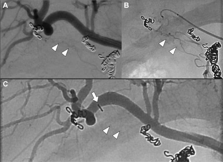 Fig. 4