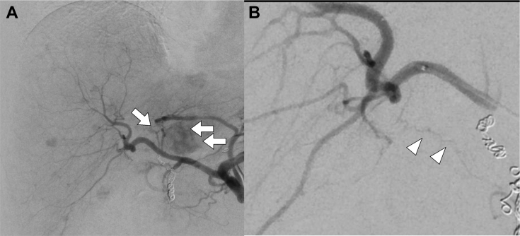 Fig. 2