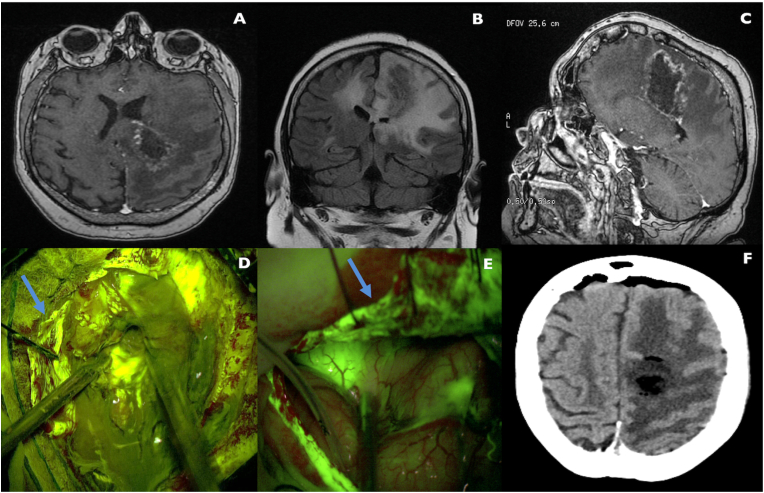 Fig. 1