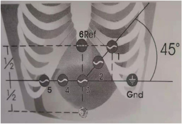 FIGURE 1