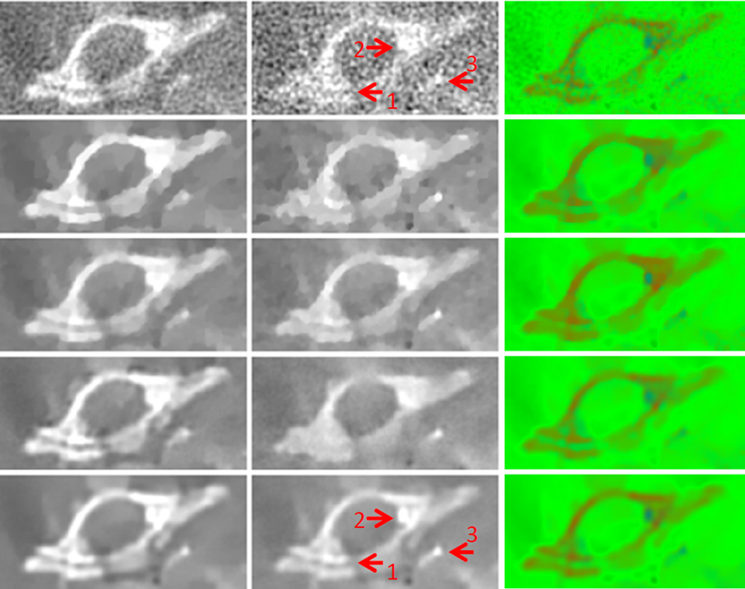 Fig. 15