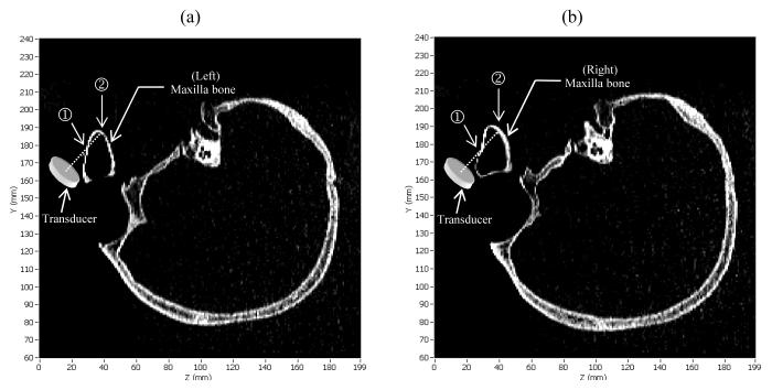 Fig. 14