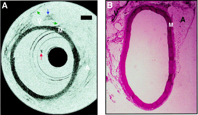 Figure 4  