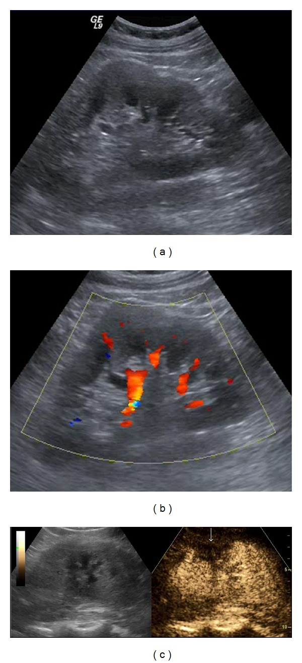 Figure 9