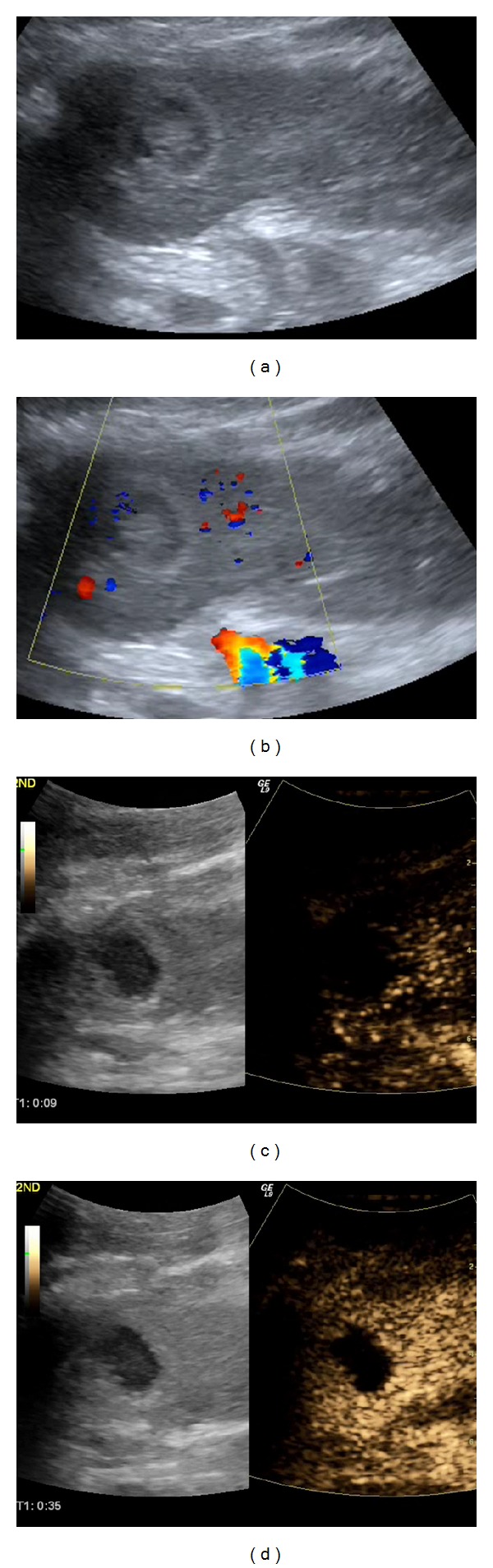 Figure 10