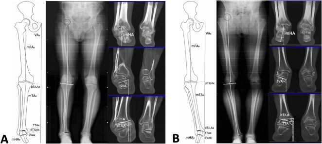 Fig. 3A-B