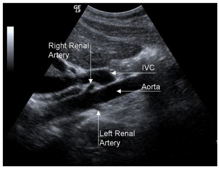 Figure 14