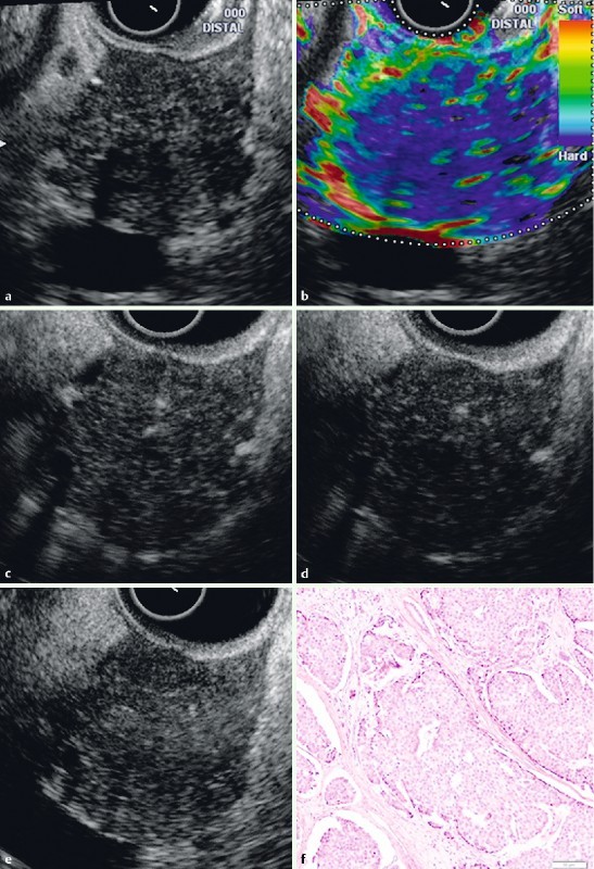 Fig. 1