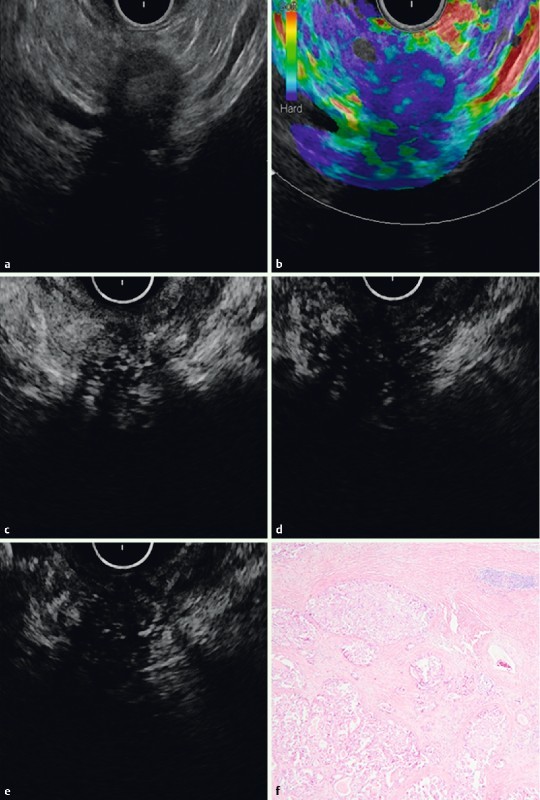 Fig. 2