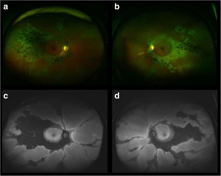 Fig. 1