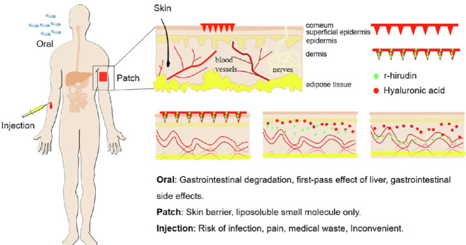 Image, graphical abstract