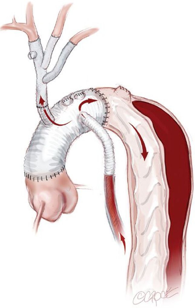 Fig. 2