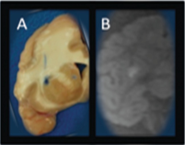 Fig. 2: