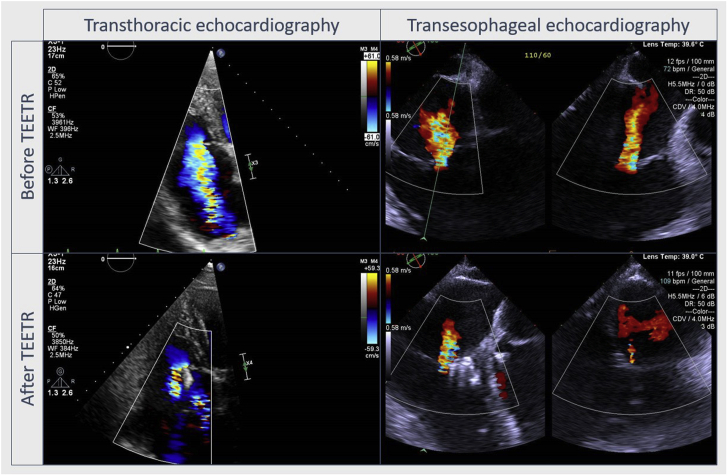 Figure 1