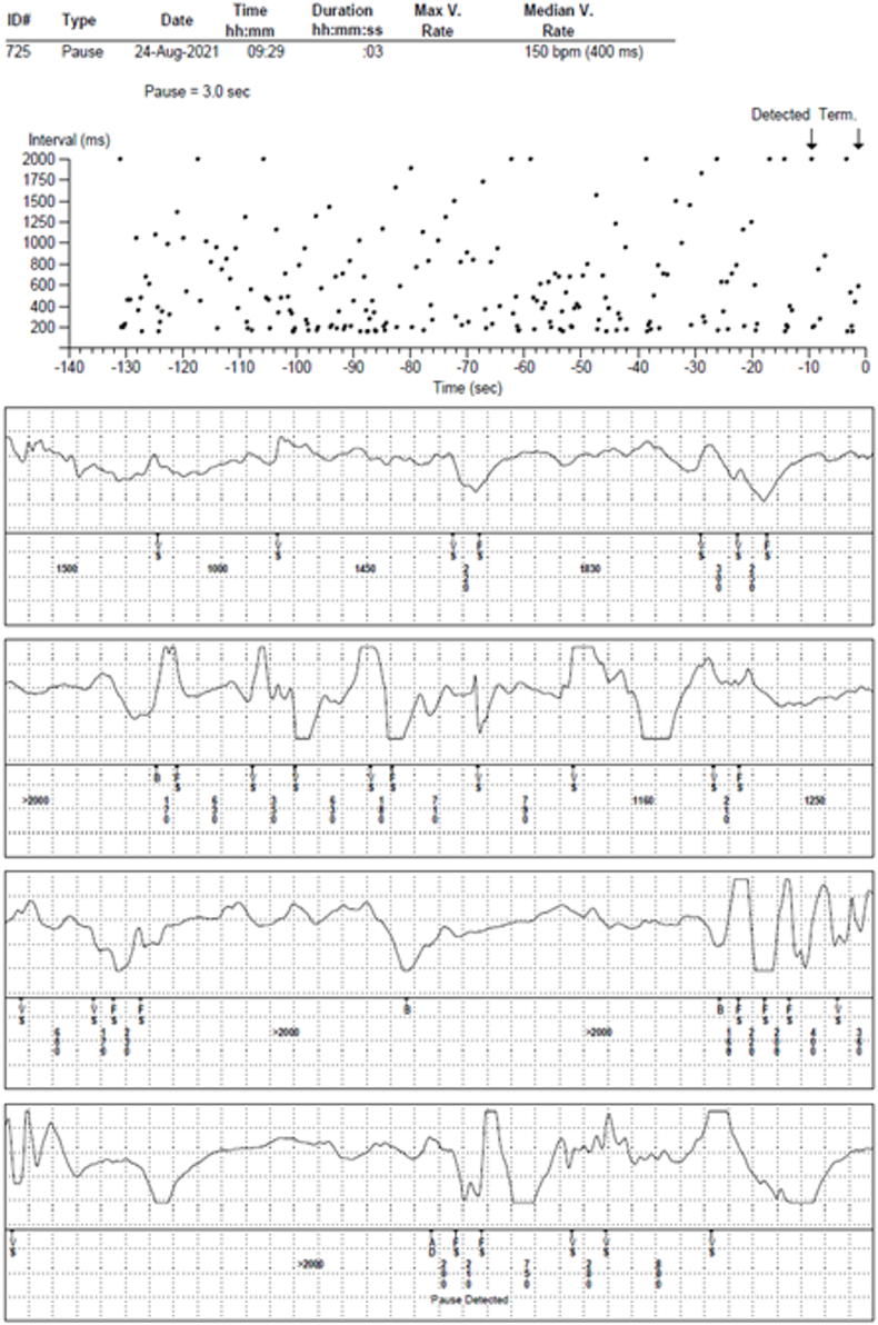 Fig. 7