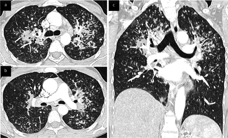 Fig. 6